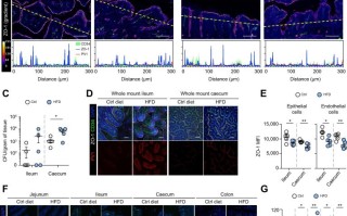 为何“大肚子”总是伴随脂肪肝？肚子上的肥肉是如何“入侵”肝脏的？